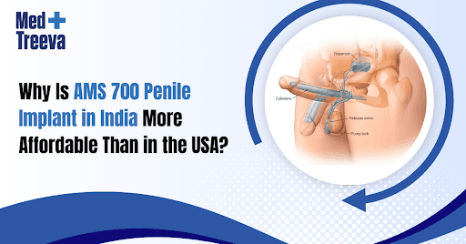 AMS 700 Penile Implant in India - Why It Costs Less Than USA