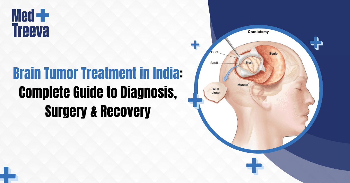 Brain Tumor Treatment in India: Complete Guide to Diagnosis, Surgery & Recovery