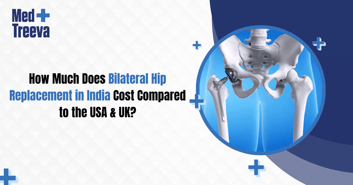 How Much Does Bilateral Hip Replacement in India Cost Compared to the USA & UK?