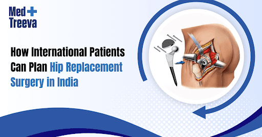 Plan Hip Replacement Surgery in India for Global Patients