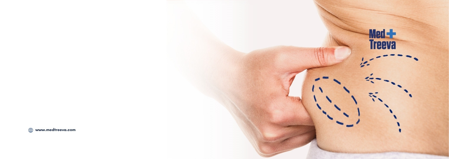 web_Advanced Liposuction Surgery in India