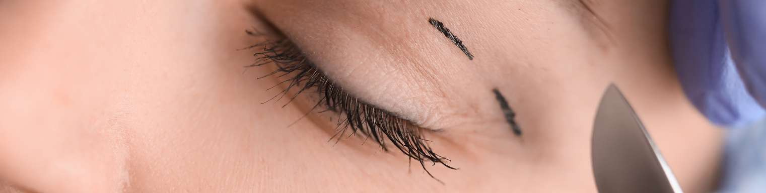 web_Advanced Oculoplasty Surgery for Eye and Eyelid Conditions