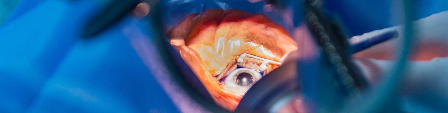 web_Affordable Cataract Surgery in India with Expert Eye Specialists