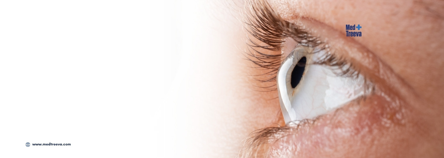 web_All-Inclusive Corneal Transplant Package in India