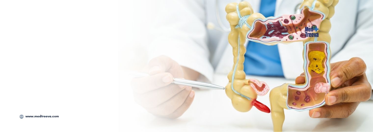 web_Appendix Surgery In India