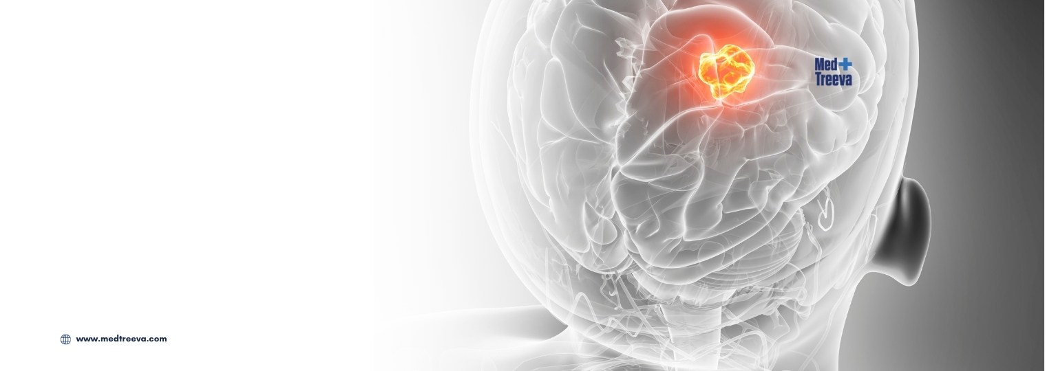 web_Brain Tumor Treatment In India