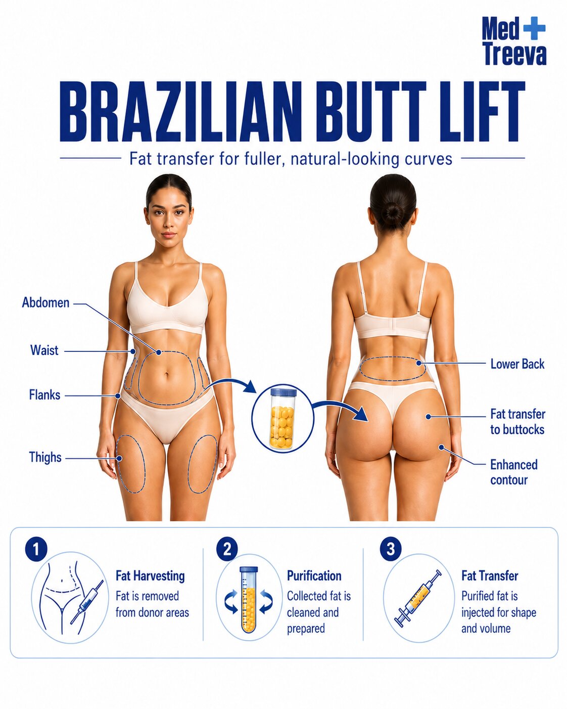 web_Brazilian Butt Lift
