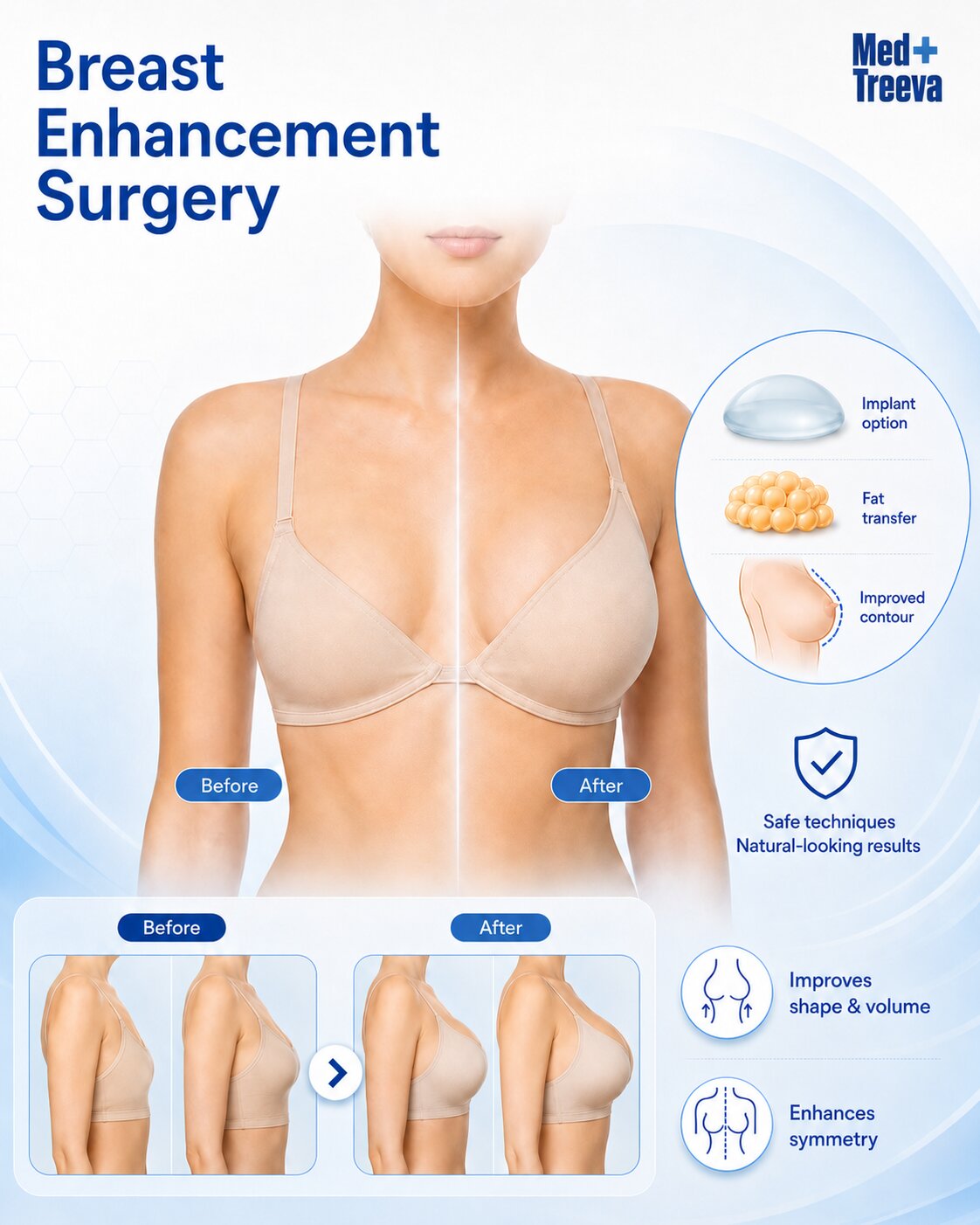 web_Breast Enhancement Surgery
