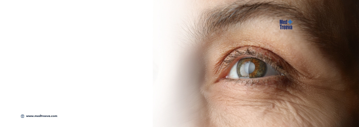 web_Cataract Surgery In India