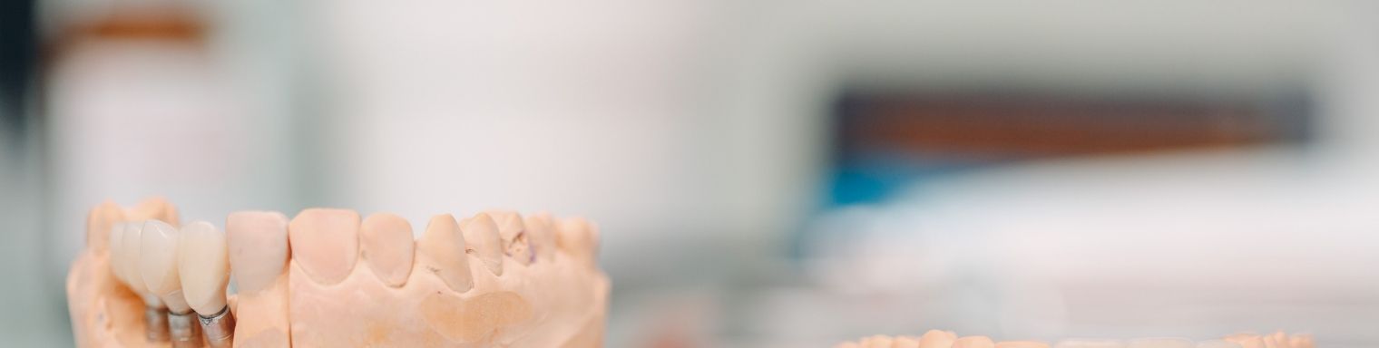 web_Choose the Right Dental Implant Type in India