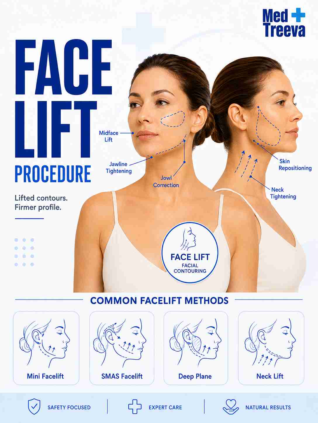 web_Facelift Surgery