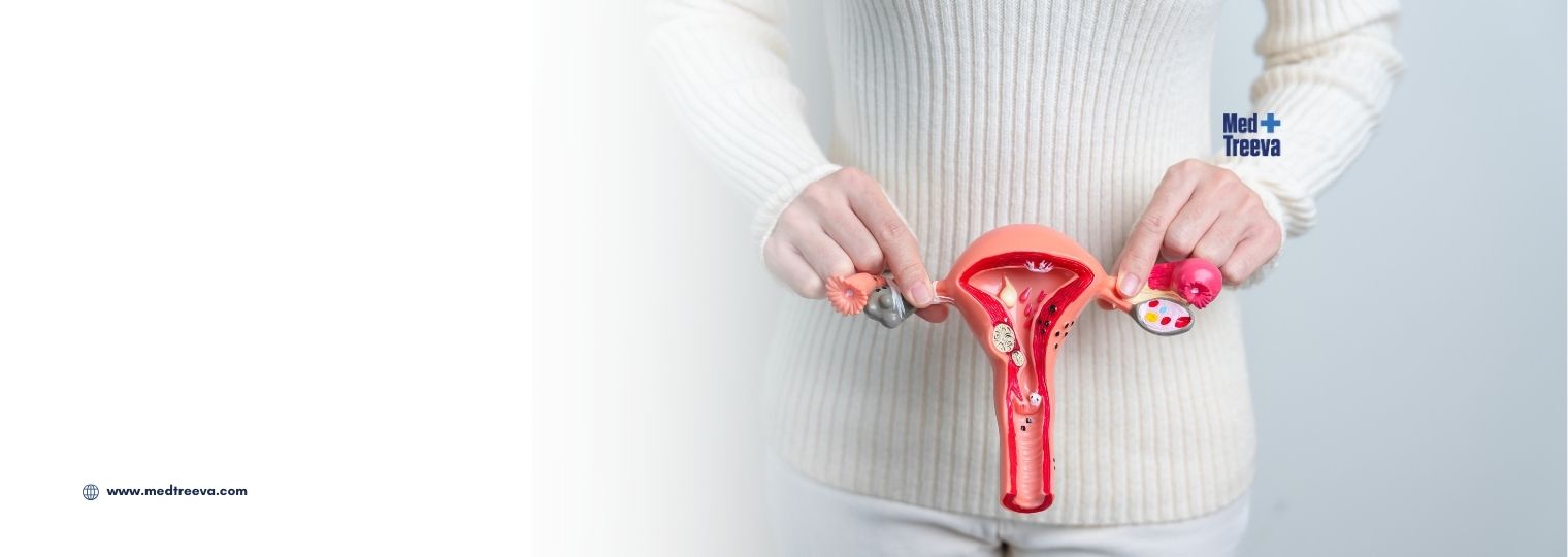 web_Fibroid Removal Surgery In India