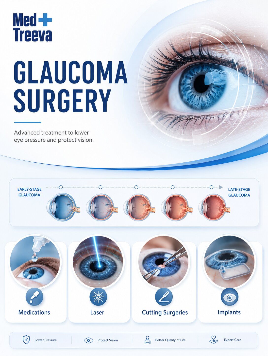 web_Glaucoma Treatment