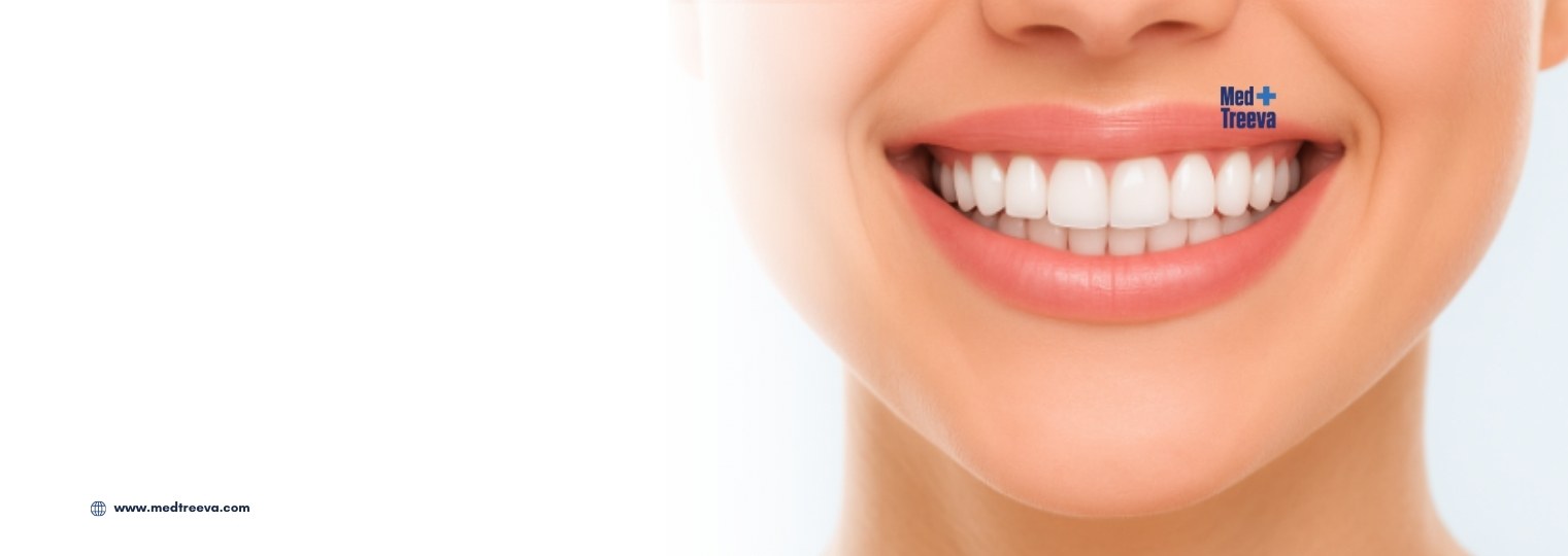web_Hollywood Smile Makeover In India