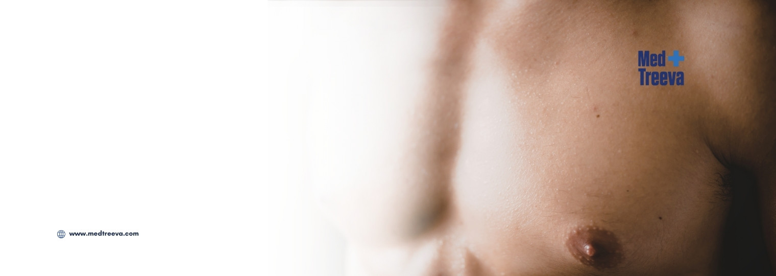 web_Male Breast Reduction Surgery in India