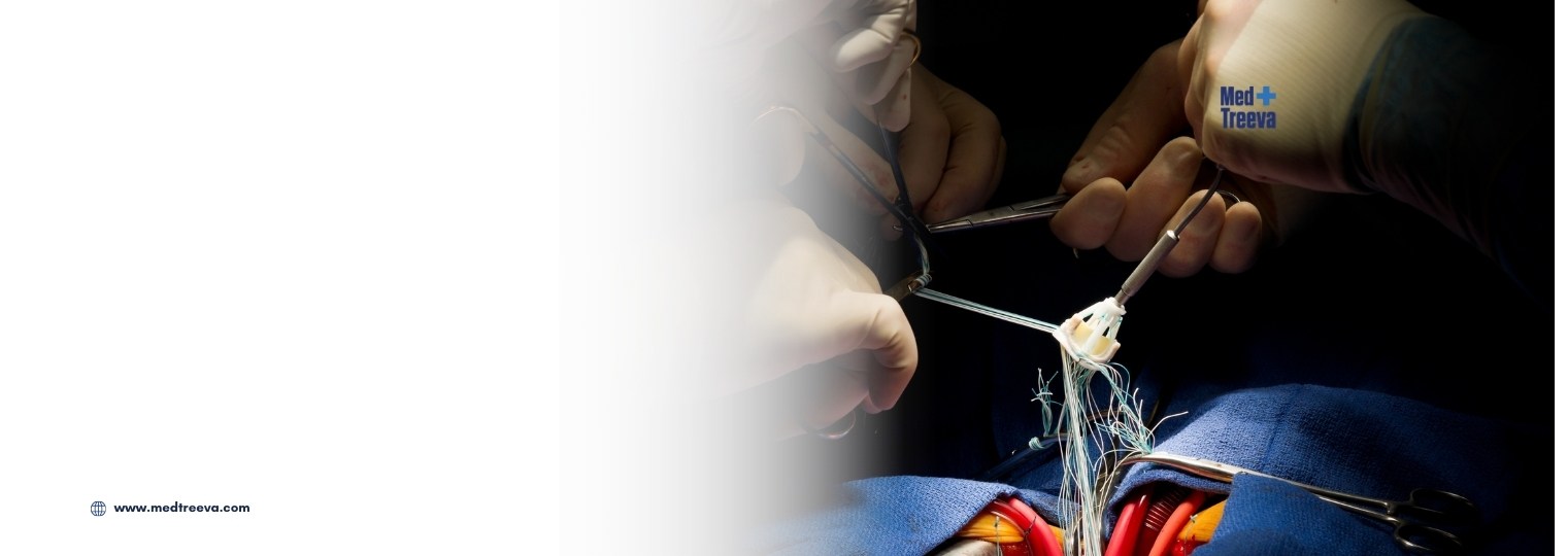 web_Mitral Valve Surgery In India