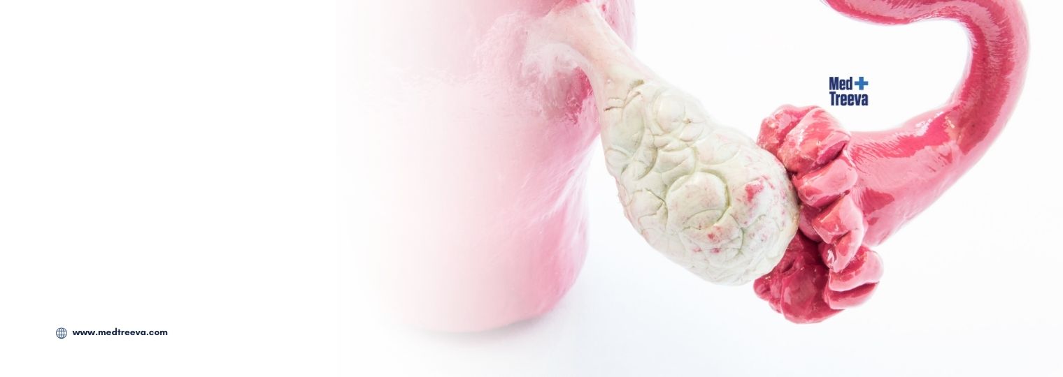 web_Ovarian Cyst Removal Surgery in India