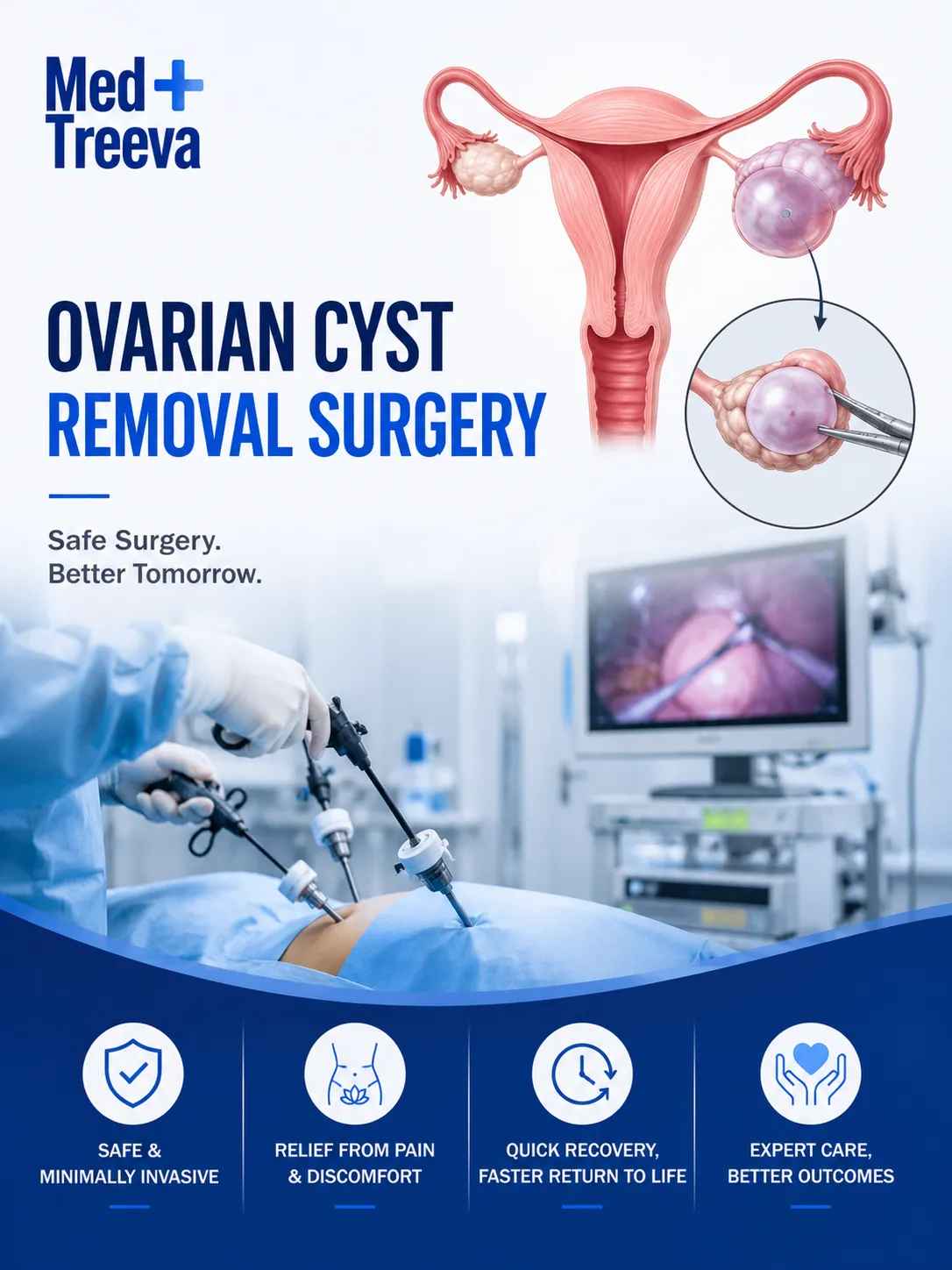 web_Ovarian Cyst Removal