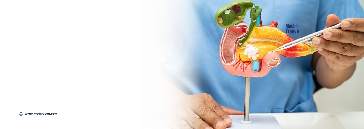 web_Pancreatic Cancer Treatment in India