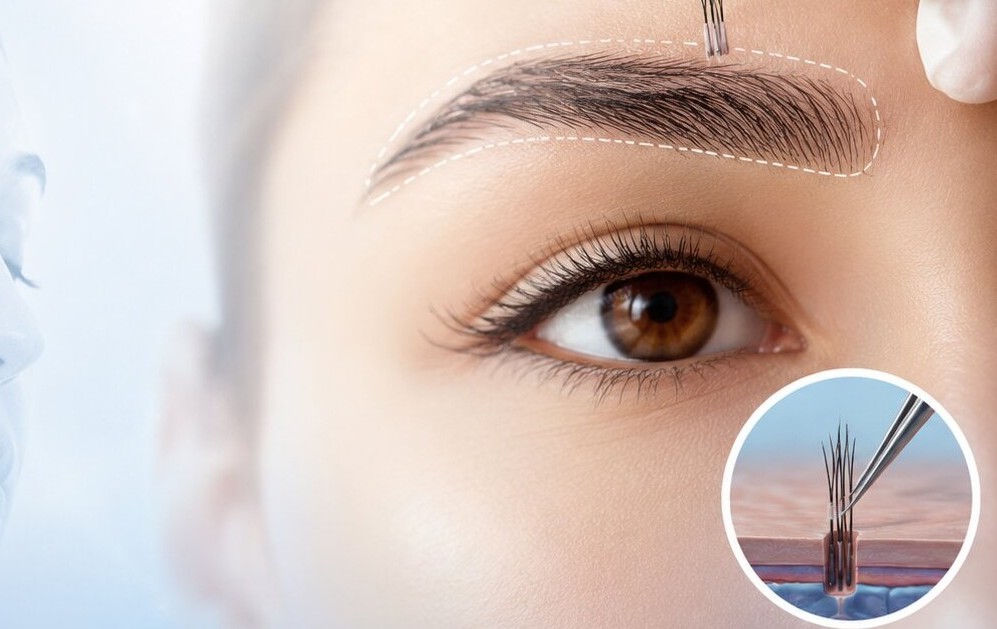 web_Restore Fuller Eyebrows with Eyebrow Transplant in India