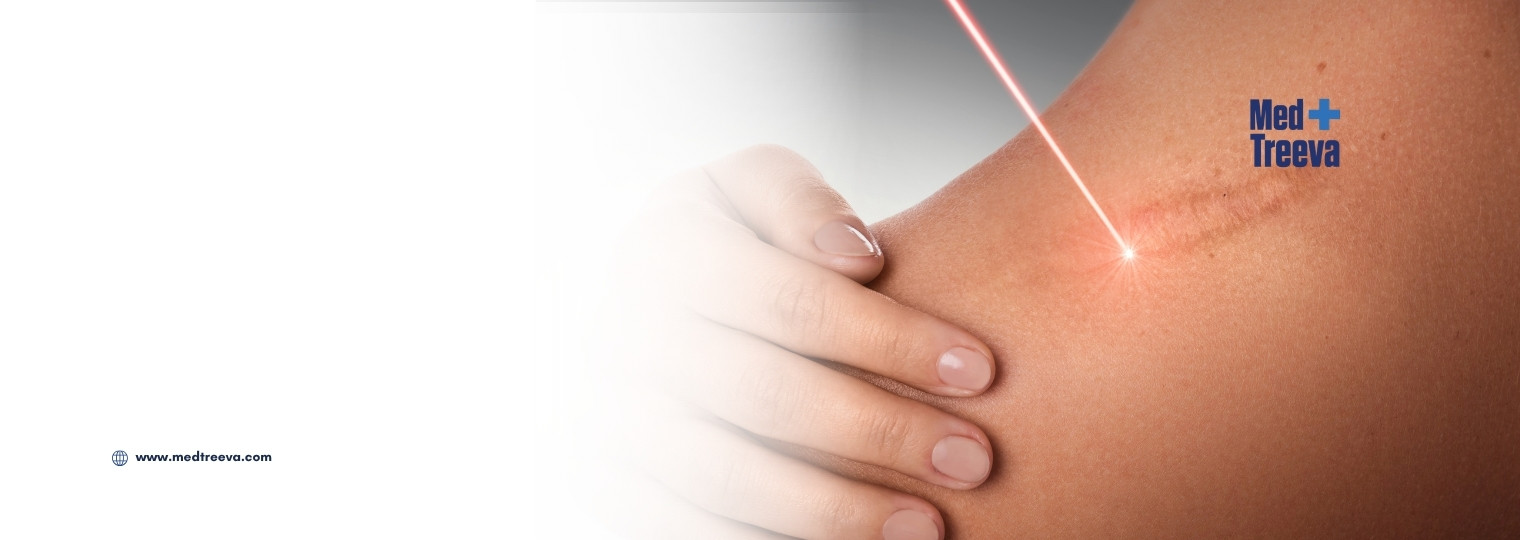 web_Scar Removal Treatment In India