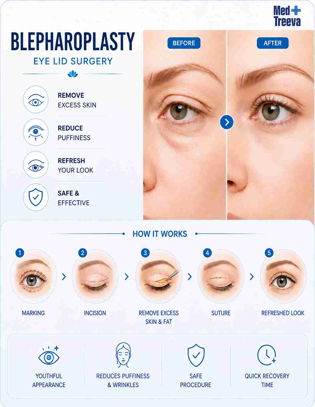 web_Step-by-Step Blepharoplasty Surgery Procedure