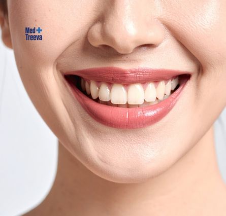 web_Step-by-Step Hollywood Smile Makeover Procedure
