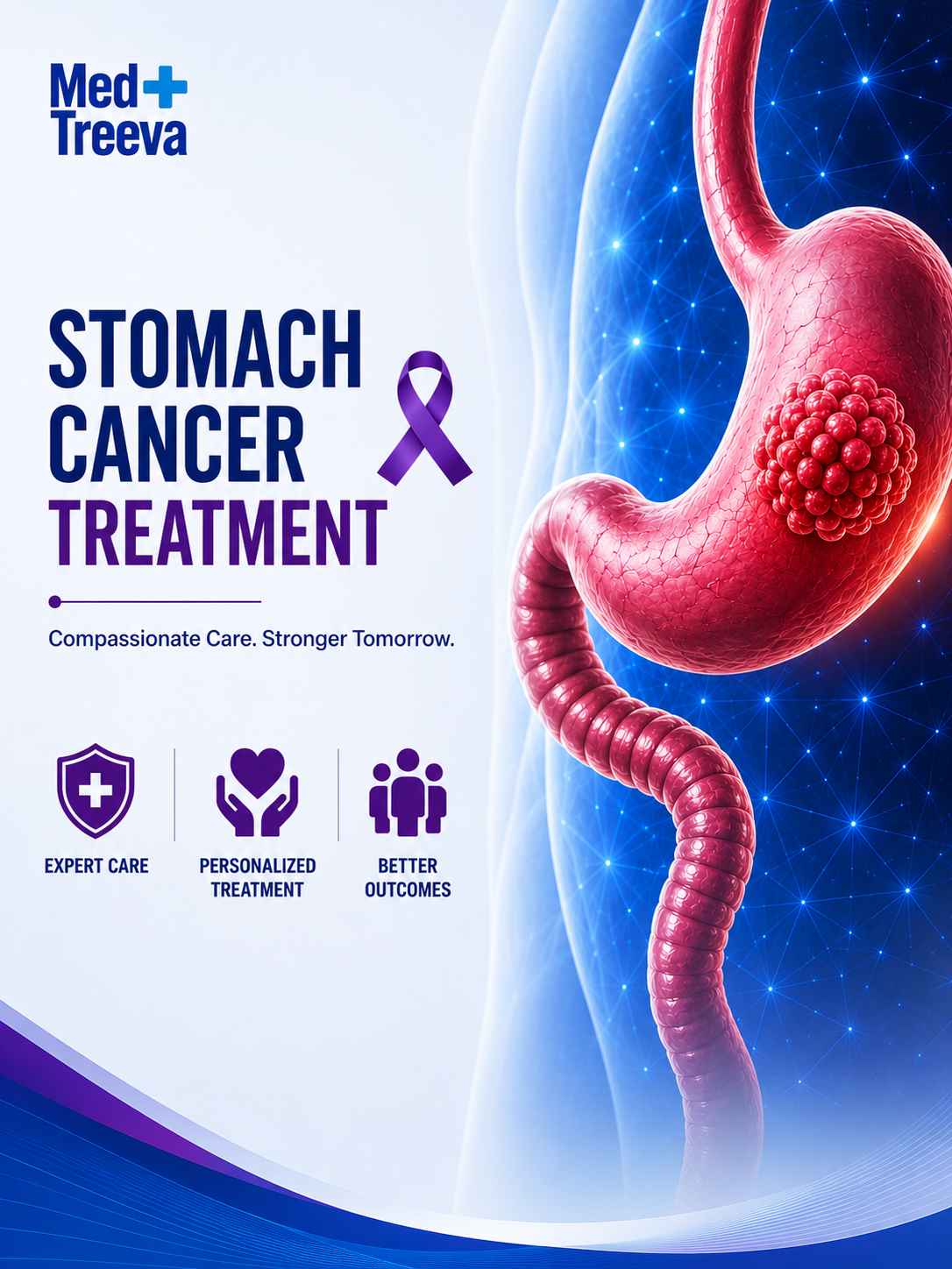 web_Stomach Cancer Treatment in India