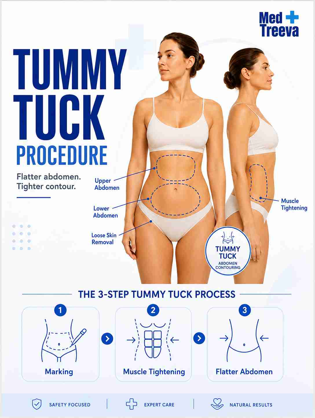 web_Tummy Tuck Surgery