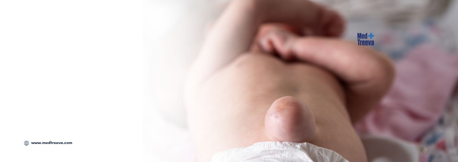 web_Umbilical Hernia Surgery in India