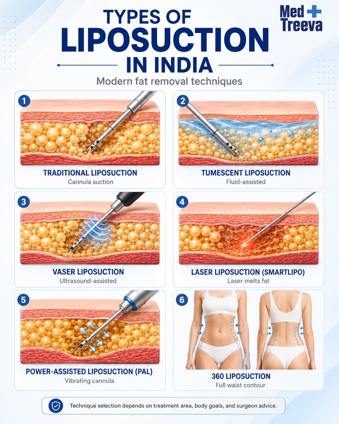 web_Understanding the Types of Liposuction in India