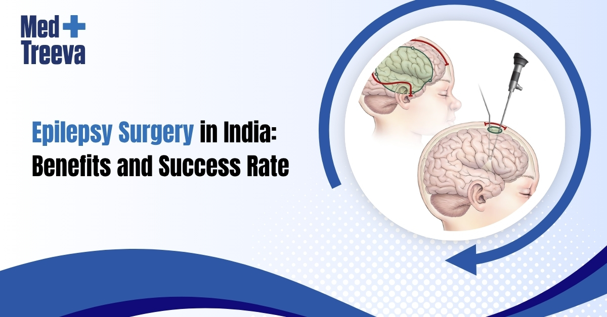 Epilepsy Surgery in India Success Rate and Top Hospitals 
