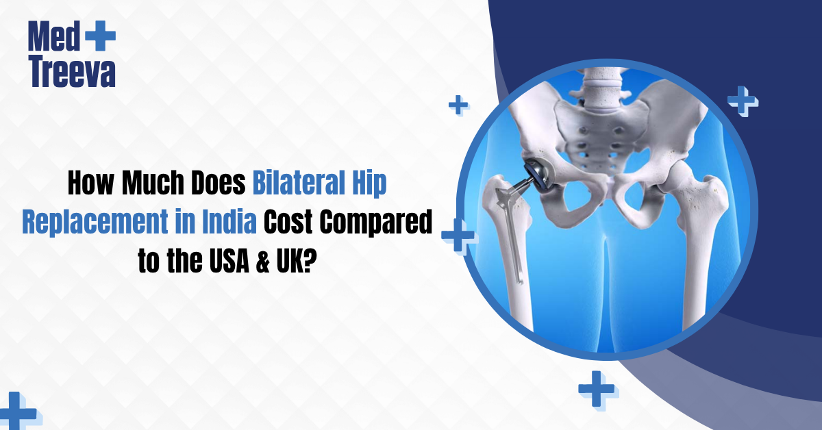 How Much Does Bilateral Hip Replacement in India Cost Compared to the USA & UK?