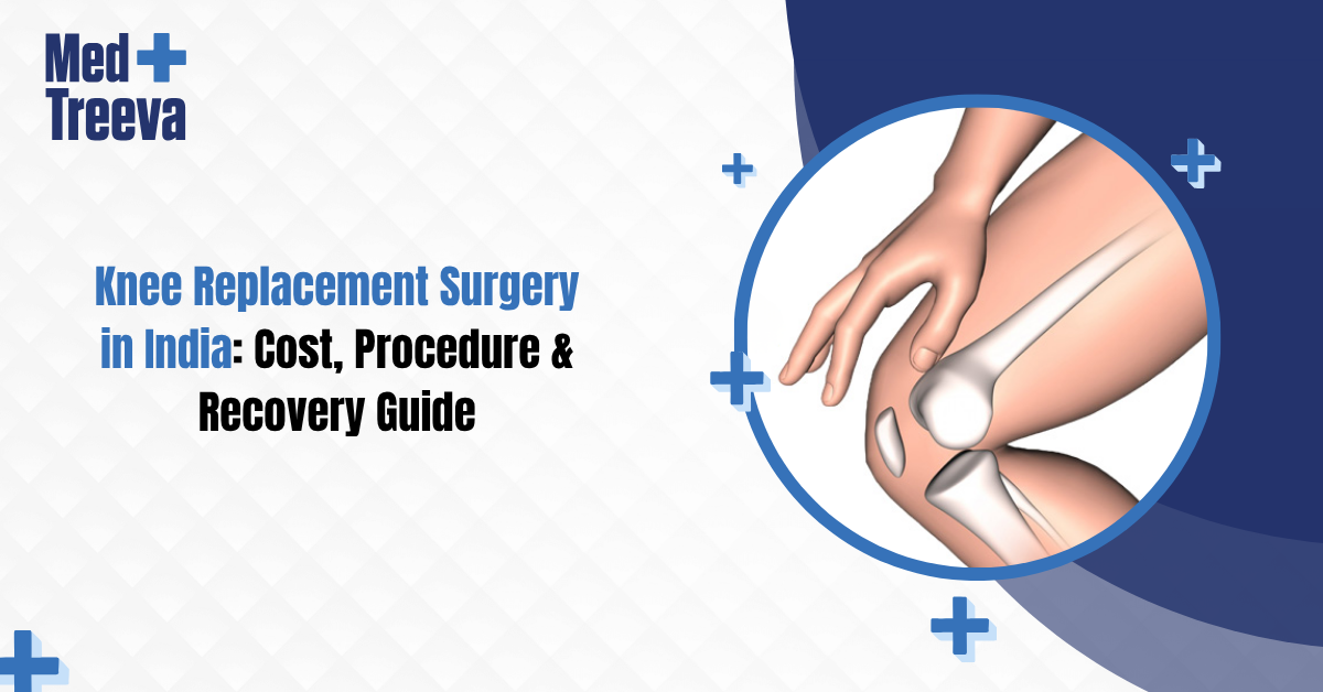 Knee Replacement Surgery in India: Cost, Procedure & Recovery Guide