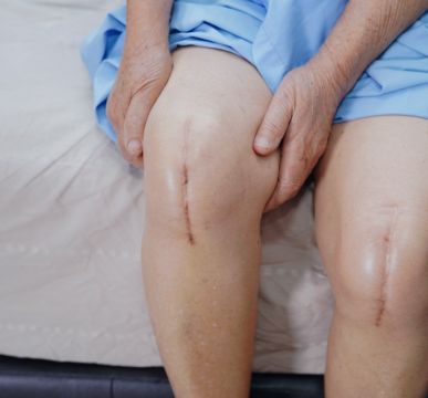 All-Inclusive Bilateral Knee Replacement Package in India
