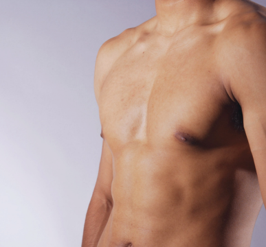 All-Inclusive Gynecomastia Package in India