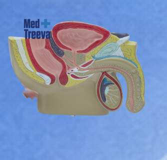 AMS 700 Penile Implant in India