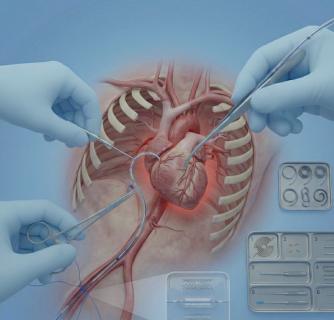 Cardiac Catheterization in India