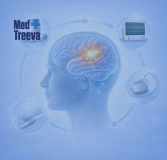 Epilepsy Treatment in India