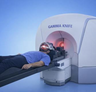 Gamma Knife Surgery in India