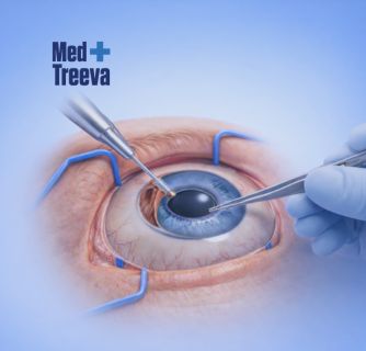 Glaucoma Treatment in India