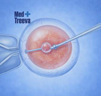 IVF Treatment in India