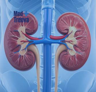 Kidney Stone Removal in India