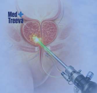 Laser Prostate Surgery in India