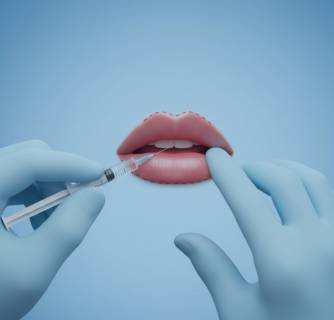 Lip Augmentation in India