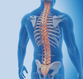 Scoliosis Treatment in India