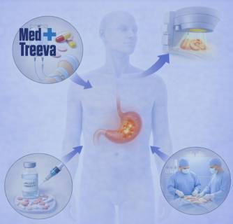 Stomach Cancer Treatment in India