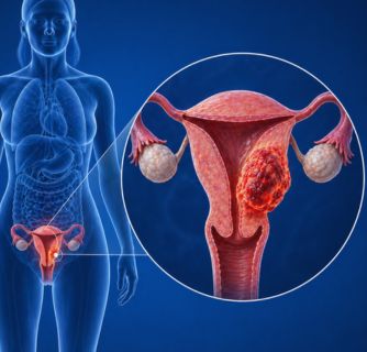 Uterus Cancer Treatment in India